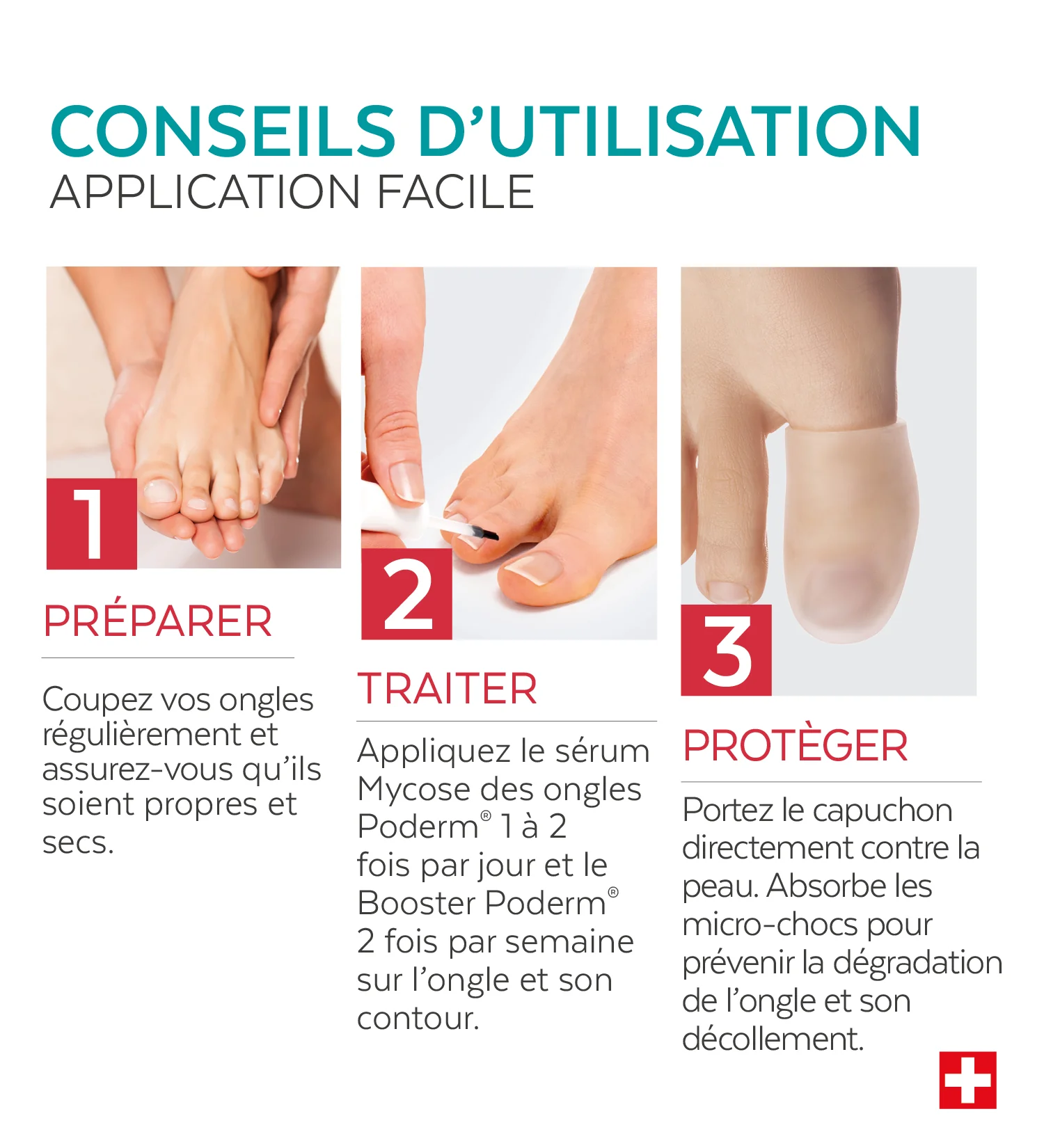 Trio Capuchon - Mycose des ongles - Image 4